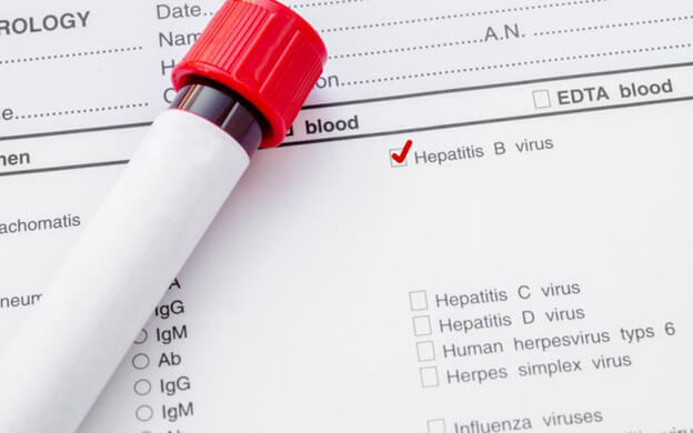 Легальные справки с результатами анализа крови на гепатит