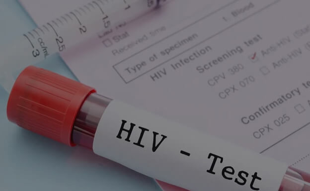 Купить отрицательный анализ на ВИЧ в СПБ за один день